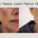 Clareador de Manchas Caseiro Poderoso Para Melasma